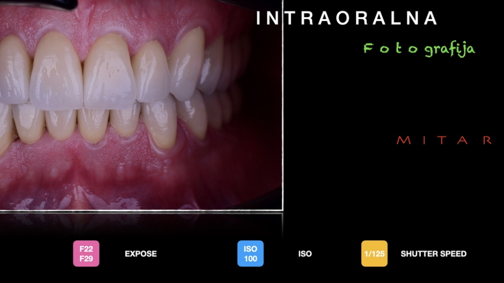 Dentalna fotografija 027